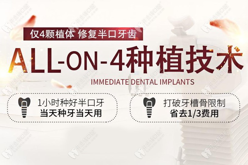 天津优贝口腔allon4种植技术介绍