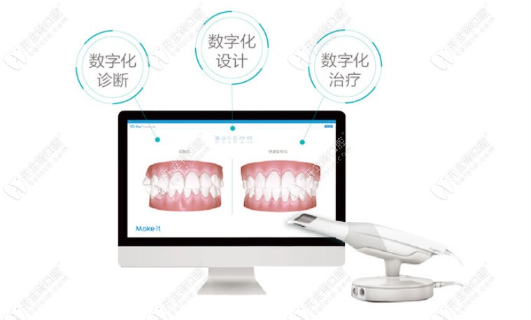 数字化正畸技术