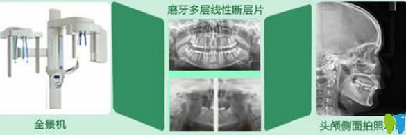 厦门峰煜口腔全套化的高端牙齿诊疗设备