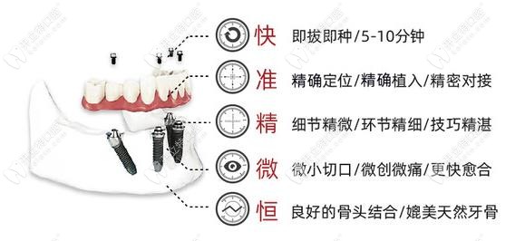 南关区富雅牙科的种植牙技术