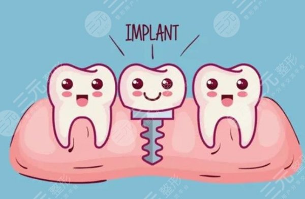 2024种植牙收费价目表大曝光，了解清楚不踩雷!