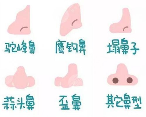 隆鼻术后20天