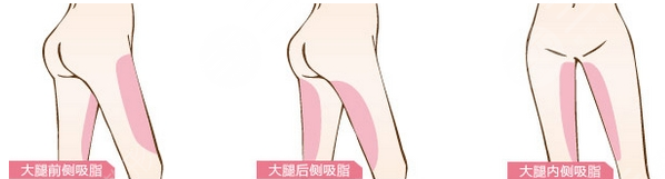 医美案例