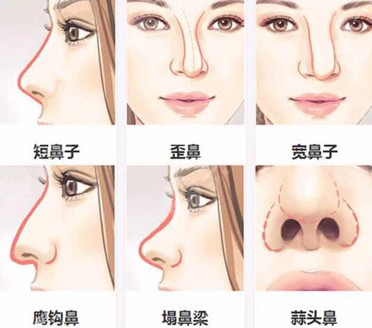 南京皮肤研究所整形美容科价格表更新，附医生介绍+整形案例~