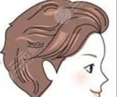 合肥碧莲盛植发医生介绍